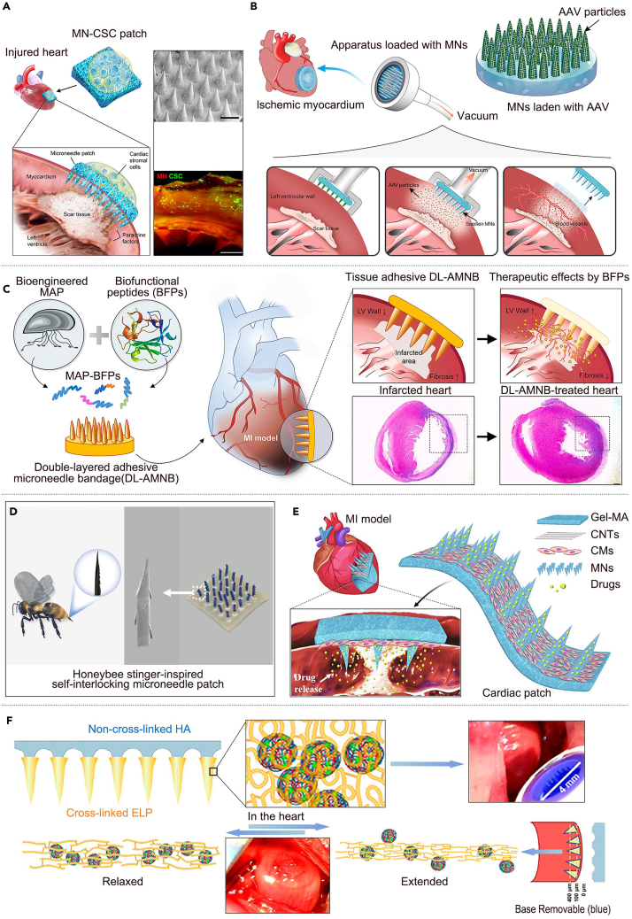 Figure 2
