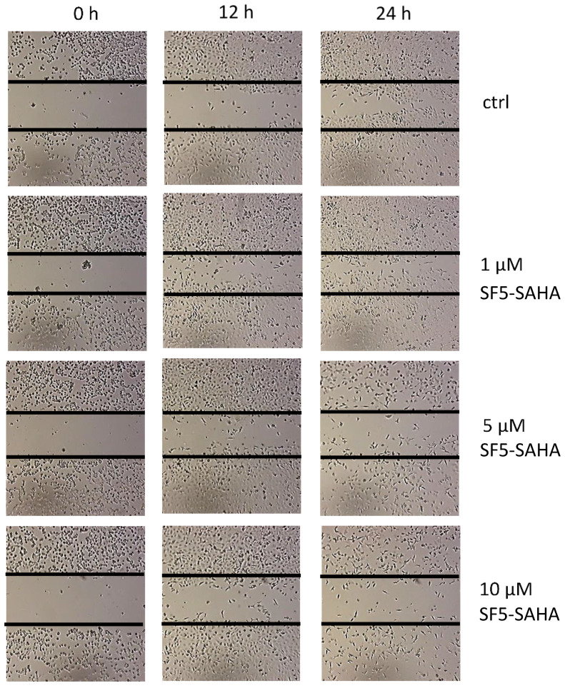 Figure 11