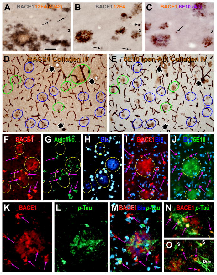 FIG. 4