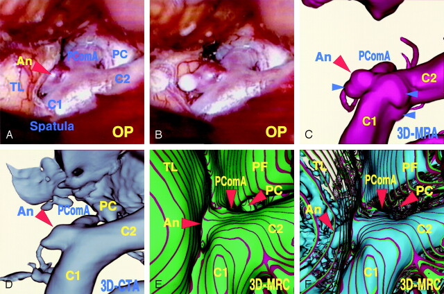 Fig 3.