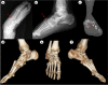 Fig. 1