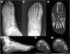 Fig. 2