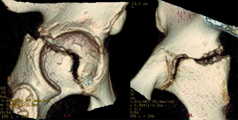 Figure 3a, b.