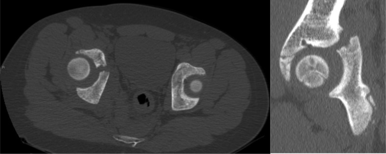 Figure 2a, b.