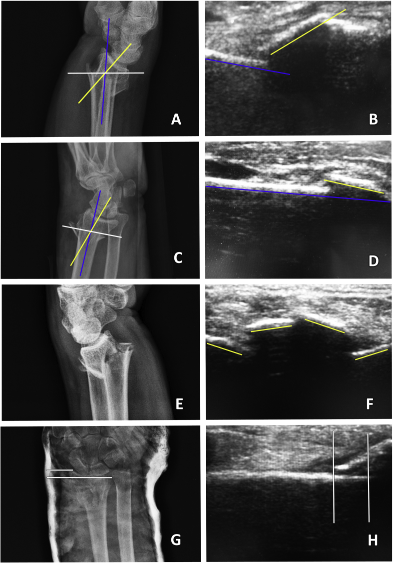 Fig. 5