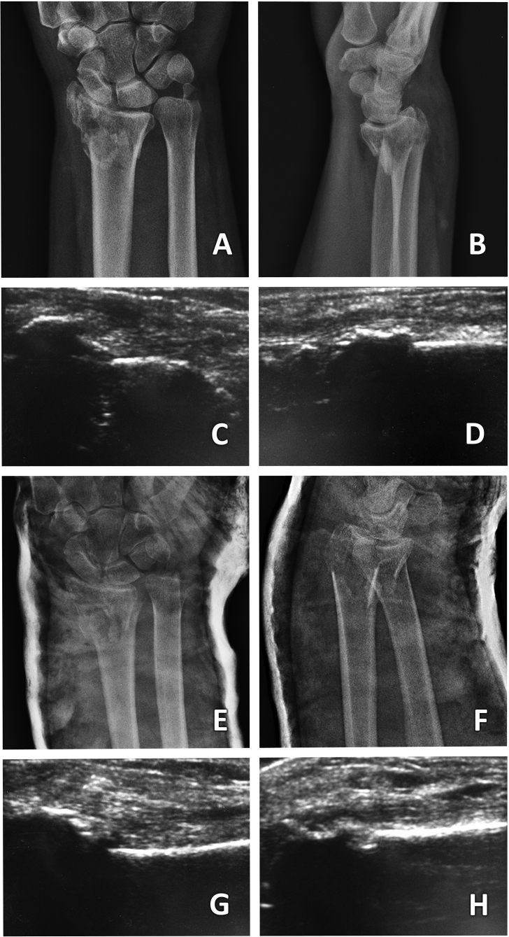 Fig. 4