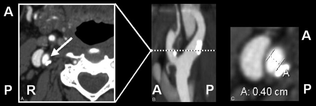 Fig 3.