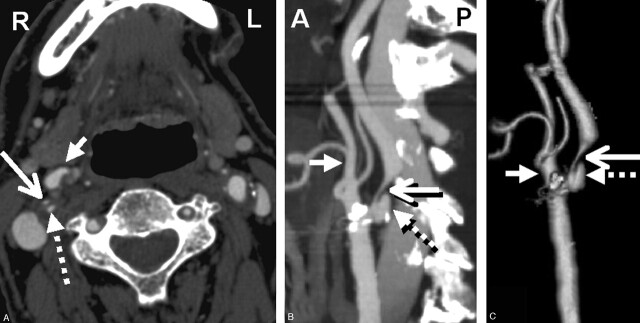 Fig 1.