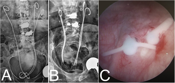 Fig. 1