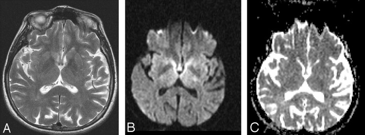 Fig 3.