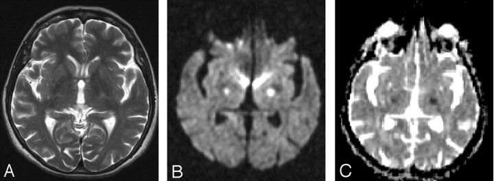 Fig 2.