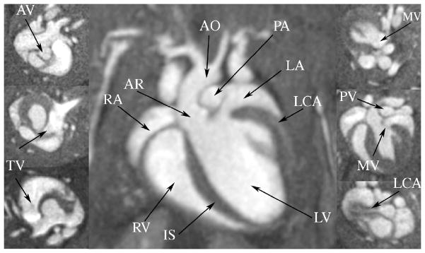 Figure 15