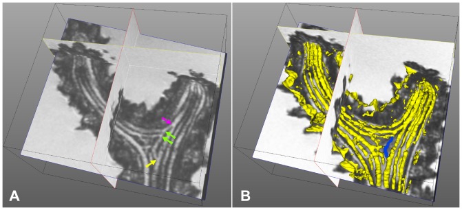 Figure 15