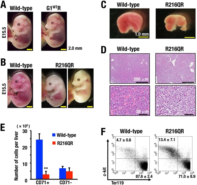 FIG 11