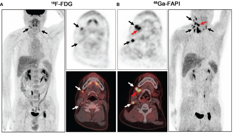 Figure 4