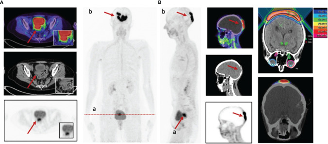 Figure 5