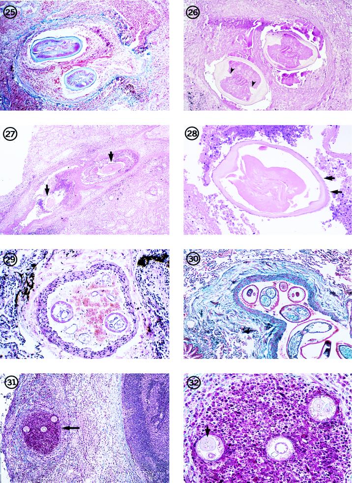 FIG. 25-32