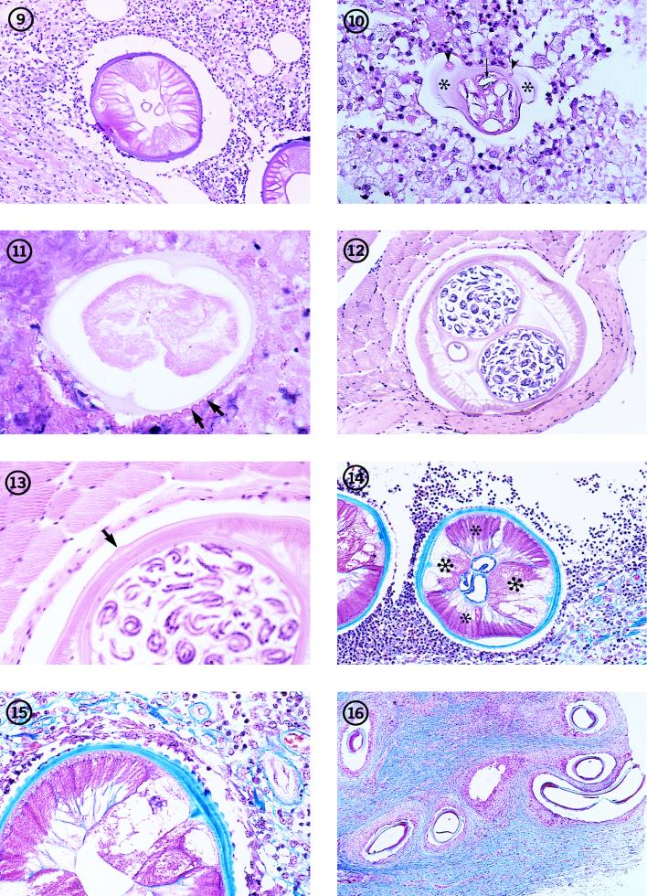 FIG. 9-16