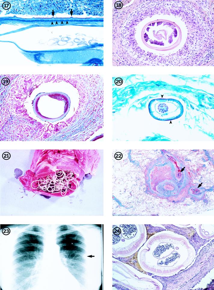 FIG. 17-24