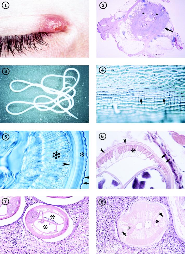 FIG. 1-8