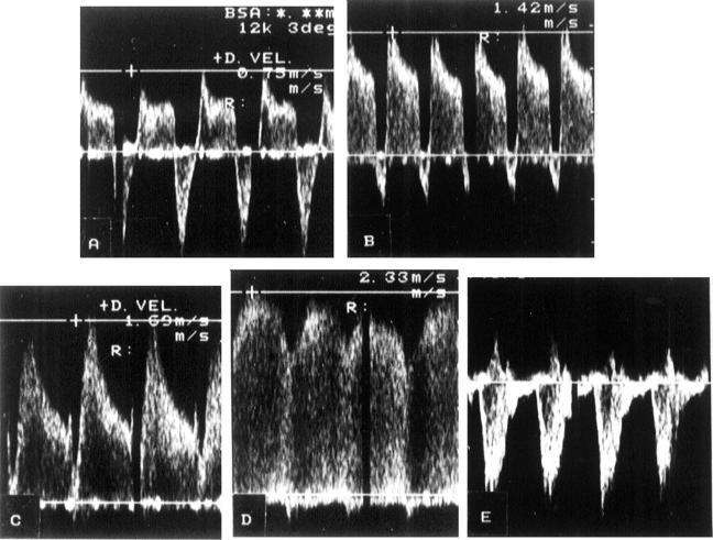 Figure 2  