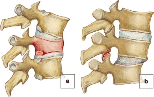 Fig. 19