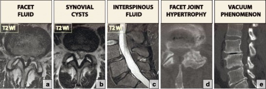 Fig. 20