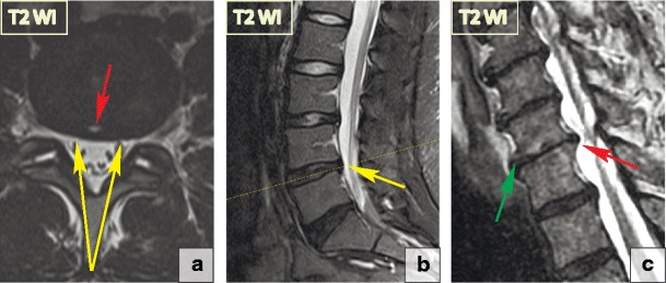 Fig. 11