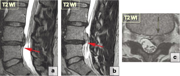 Fig. 14