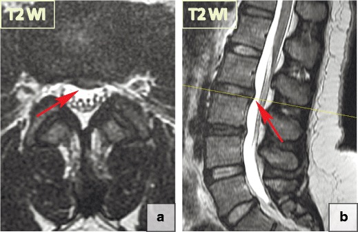 Fig. 12