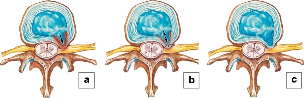 Fig. 15