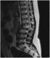 Fig. 32