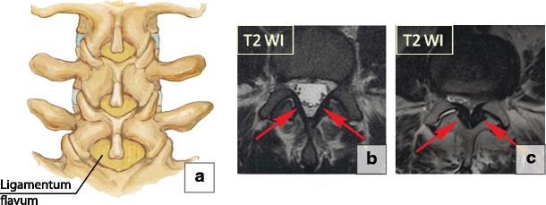 Fig. 26