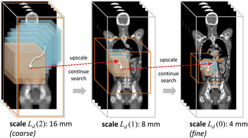 FIGURE 11