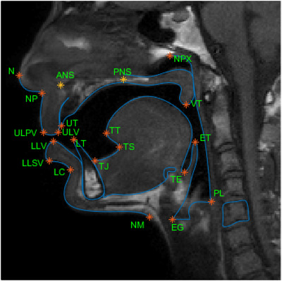 FIGURE 9