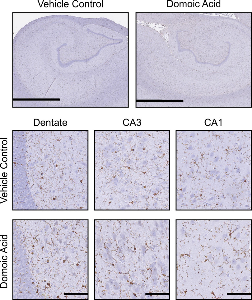 Figure 5 is divided into two parts. On the top, two stained tissues are displayed titled Vehicle Control and Domoic Acid, depicting hippocampal ionized calcium binding adaptor molecule 1 immunoreactivity. At the bottom, a stained tissue displays three columns, namely, Dentate, cornu Ammonis 3 and cornu Ammonis 1, and rows, namely, Vehicle Control and Domoic Acid.