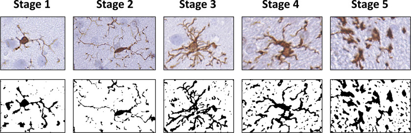 Figure 2 is a set of ten images, depicting a rating scale from 1 to 5 for ionized calcium binding adaptor protein positive microglia with its related progressive change in morphology.