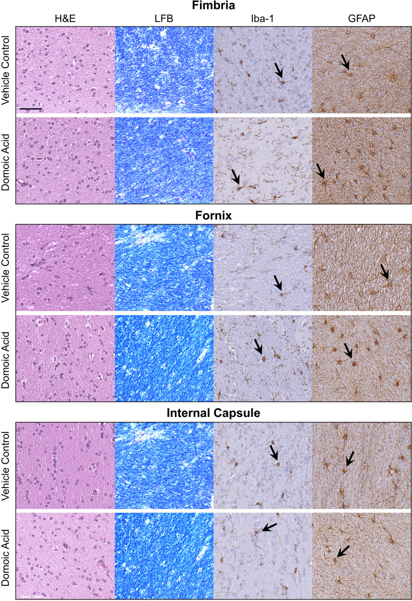 Figure 4 is a set of three stained tissues titled Fimbria, Fornix, and Internal Capsule, displaying four columns, namely, hematoxylin and eosin, Luxol fast blue, ionized calcium binding adaptor molecule 1, and glial fibrillary acidic protein, and two rows, namely, vehicle control and domoic acid, respectively.