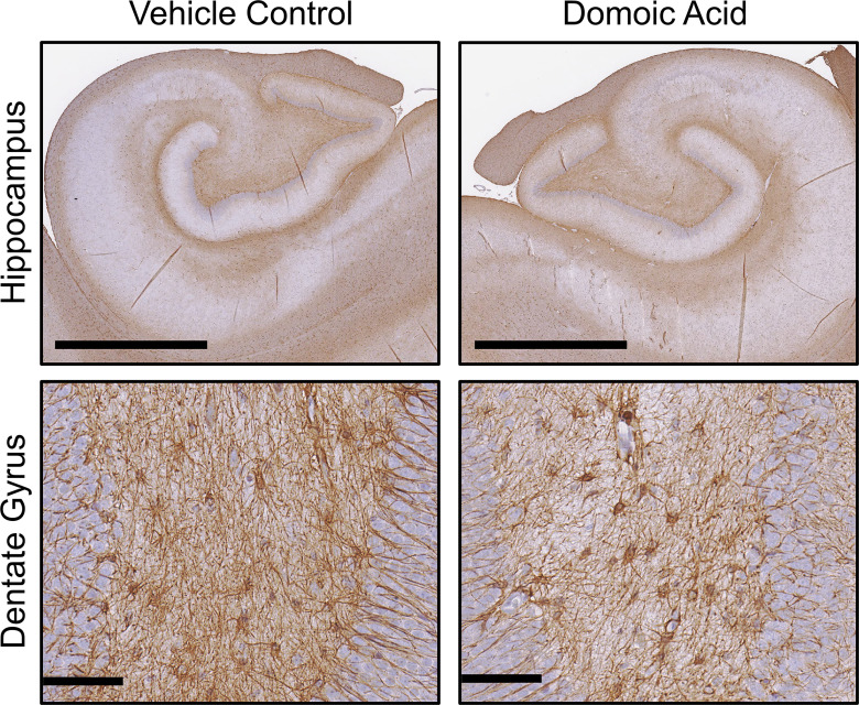 Figure 7 is a set of two stained tissues titled Vehicle Control and Domoic Acid, depicting immunohistochemistry of glial fibrillary acidic protein positive astrocytes in the hippocampus and the dentate gyrus.