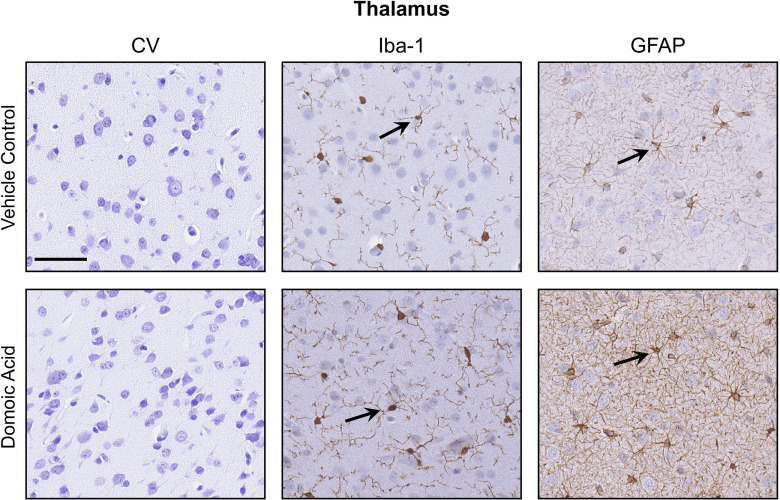 Figure 6 is a stained tissue titled Thalamus, displaying three columns, namely, Cresyl violet, Ionized calcium binding adaptor molecule 1 and Glial fibrillary acidic protein, and two rows, namely, Vehicle Control and Domoic Acid.