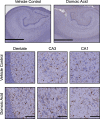 Figure 5 is divided into two parts. On the top, two stained tissues are displayed titled Vehicle Control and Domoic Acid, depicting hippocampal ionized calcium binding adaptor molecule 1 immunoreactivity. At the bottom, a stained tissue displays three columns, namely, Dentate, cornu Ammonis 3 and cornu Ammonis 1, and rows, namely, Vehicle Control and Domoic Acid.
