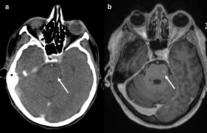 Figure 11.