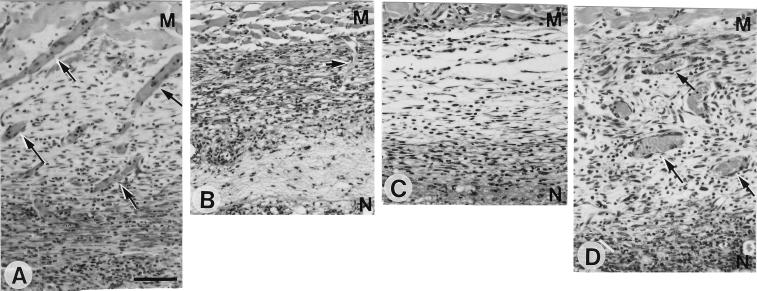 FIG. 11