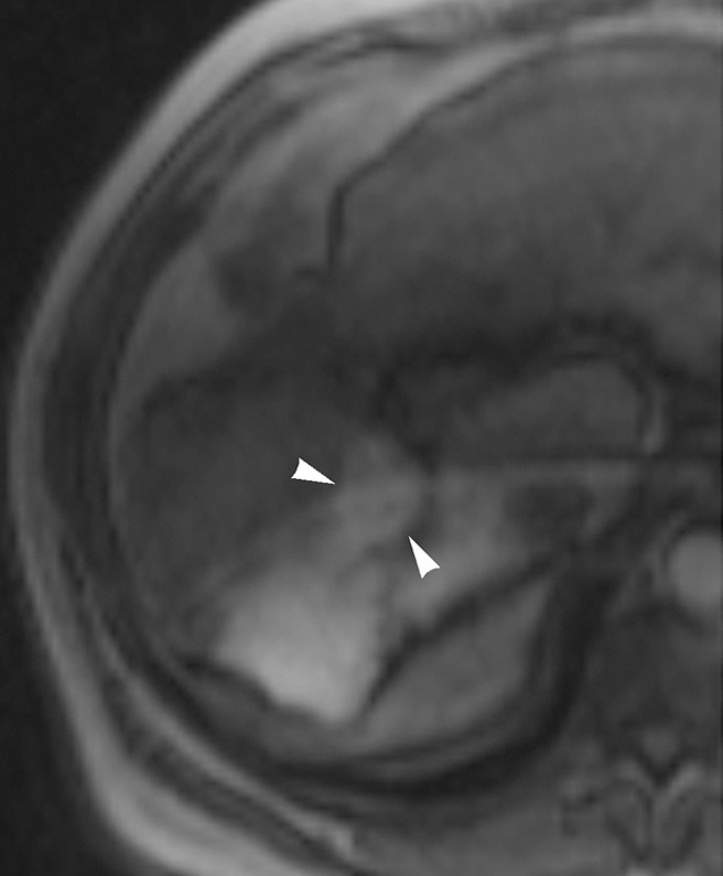 Figure 2c: