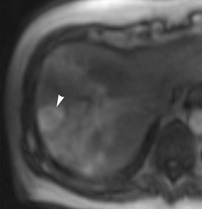 Figure 1c: