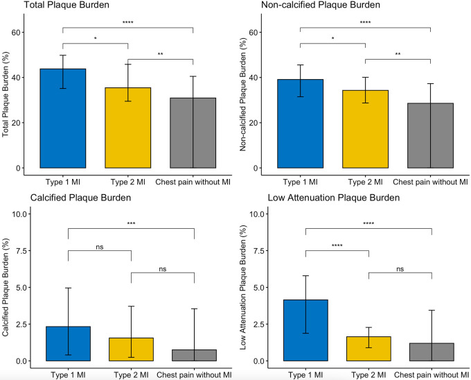 Comparison of plaque burden subtypes in patients with type 1 myocardial infarction, type 2 myocardial infarction, and acute chest pain without myocardial infarction. Histograms (medians ± IQRs) comparing burden of plaque subtypes demonstrate that participants with type 1 myocardial infarction had higher burdens of total, noncalcified, and low-attenuation plaque burden. MI = myocardial infarction, ns = not significant, * = P < .05, ** = P < .01, *** = P < .001, **** = P < .0001.