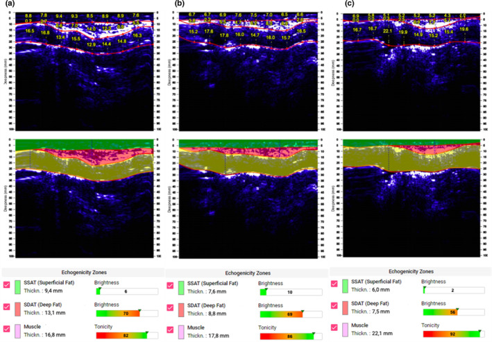 FIGURE 3