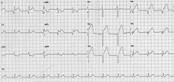 Figure 1