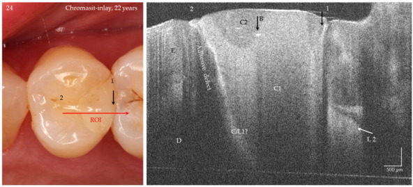 Figure 16