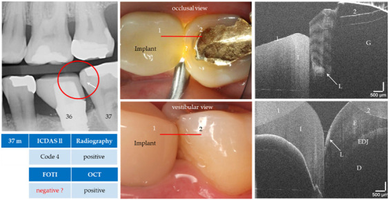 Figure 13